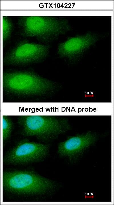 IRAK3 / IRAKM / IRAK-M Antibody (aa58-357)
