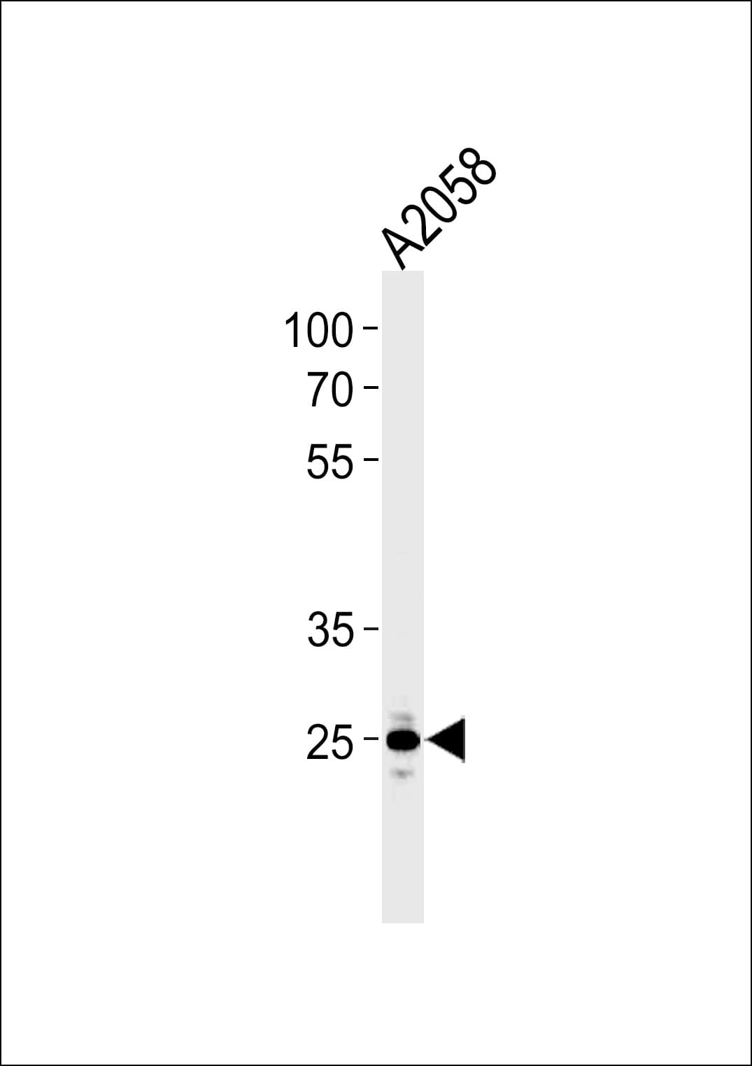 MRPL28 Antibody (aa28-55)