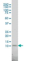 PCNA-Associated Factor Antibody (clone 3C11-1F11)