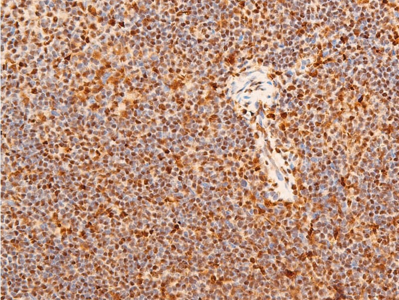 JUN / c-Jun Antibody (phospho-Ser243)