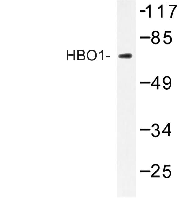 Polyclonal Rabbit anti-Human MYST2 / HBO1 Antibody (Ser167, IF, WB)