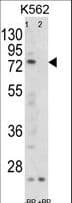 Polyclonal Rabbit anti-Human FLCN / Folliculin Antibody (aa505-534, IHC, WB)