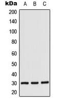 CSNK1A1 / CK1 Alpha Antibody (Internal)