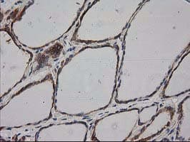 HDAC6 Antibody (clone OTI3E7)