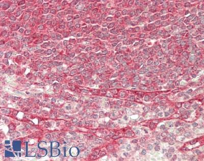 IHC-plus™ TGFA / TGF Alpha Antibody