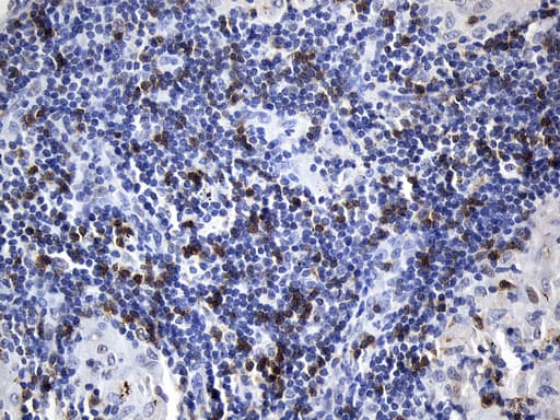 Monoclonal Mouse anti-Human CD8A / CD8 Alpha Antibody (clone UMAB241, Carrier-free, aa22-182, IHC)