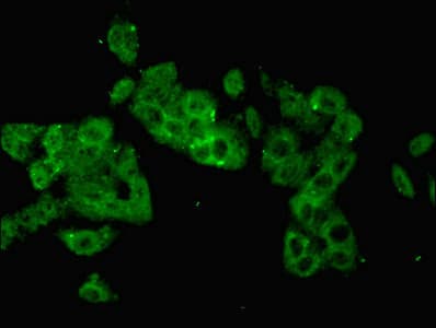 KRT14 / CK14 / Cytokeratin 14 Antibody (aa1-472)