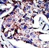 DGKD Antibody (aa1061-1091)