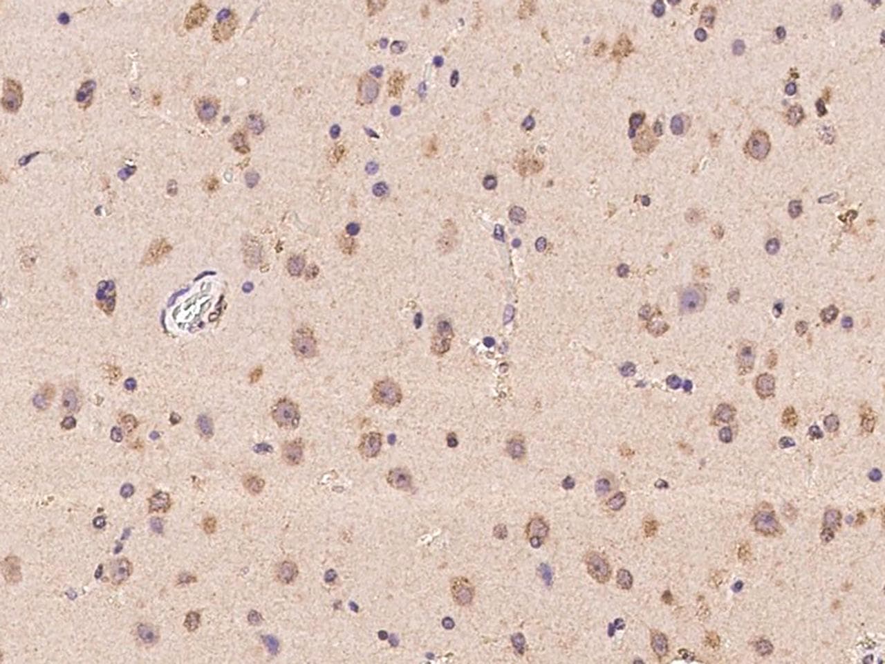 PNMA2 / MA2 Antibody