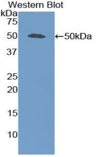 SPP1 / Osteopontin Antibody (aa17-300)