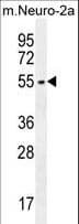 ZDHHC1 Antibody (aa14-43)