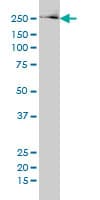 Monoclonal Mouse anti-Human FASN / Fatty Acid Synthase Antibody (clone 3F2-1F3, IF, WB)