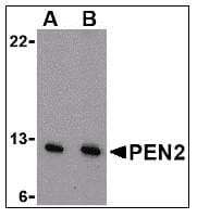 PathPlus™ PSENEN / PEN-2 Antibody