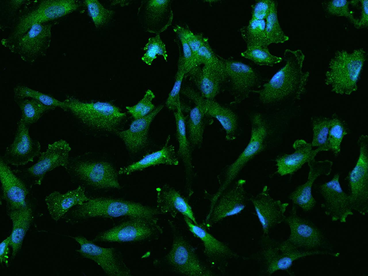 PYGL Antibody