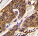 CFD / Factor D / Adipsin Antibody (aa68-99)