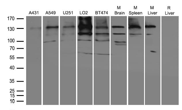 Polyclonal Rabbit anti-Human DDB1 Antibody (WB)
