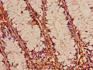FOXK1 / MNF Antibody