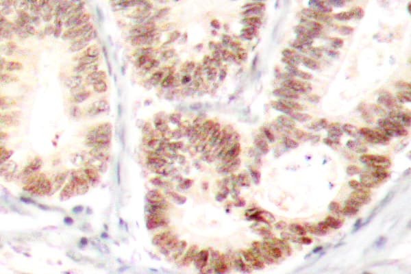Polyclonal Rabbit anti-Human MAPK14 / p38 Antibody (phospho-Tyr182, IHC, WB)
