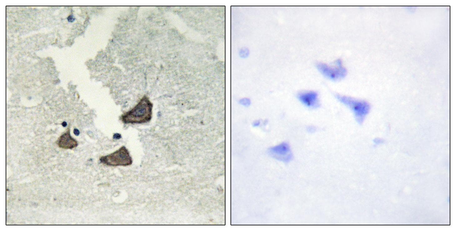 EPHB6 / EPH Receptor B6 Antibody