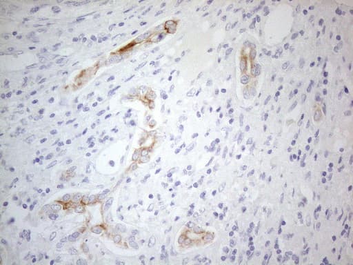ERBB3 / HER3 Antibody (aa983-1342, clone OTI3C1)