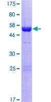 Human PROSC Protein (Recombinant GST)