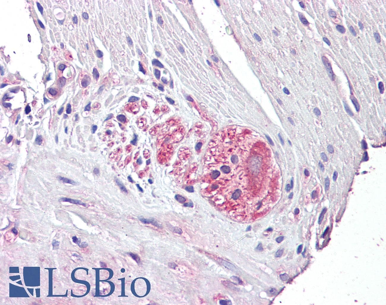 IHC-plus™ NTN4 / Netrin 4 Antibody (aa65-76)