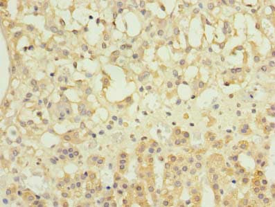 Polyclonal Rabbit anti-Human NME7 Antibody (aa1-150, IHC, WB)
