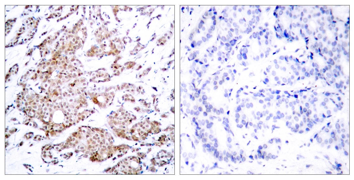 MYC / c-Myc Antibody (phospho-Thr58)