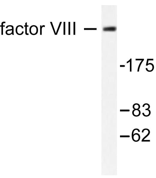 F8 / FVIII / Factor VIII Antibody (Ser2194)