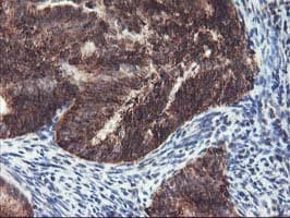 TRAP1 / HSP75 Antibody (clone OTI1A1)
