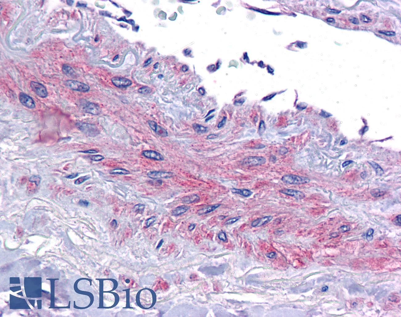 IHC-plus™ EIF5A Antibody (aa13-27)