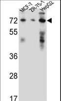 Polyclonal Rabbit anti-Human HSD17B4 Antibody (aa341-370, IHC, WB)