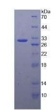 Human ATXN1 / SCA1 Protein (Recombinant His-T7)