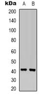 Polyclonal Rabbit anti-Human MAP2K6 / MEK6 / MKK6 Antibody (N-Terminus, IHC, IF, WB)