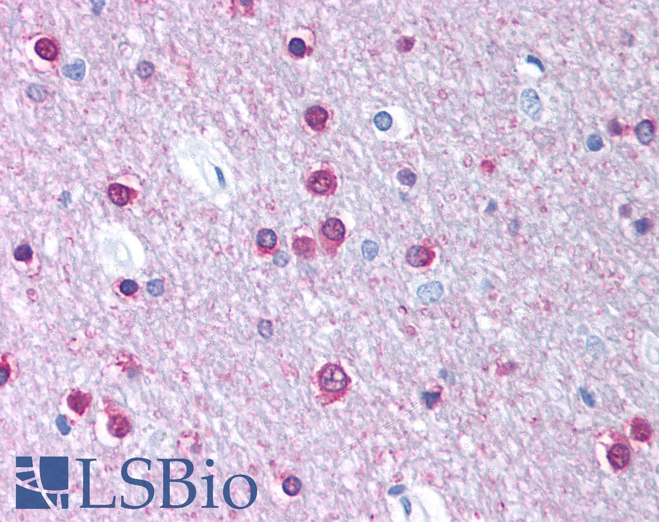 CACNB1 Antibody (aa21-70)