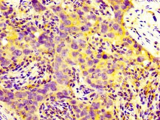 MIA2 Antibody