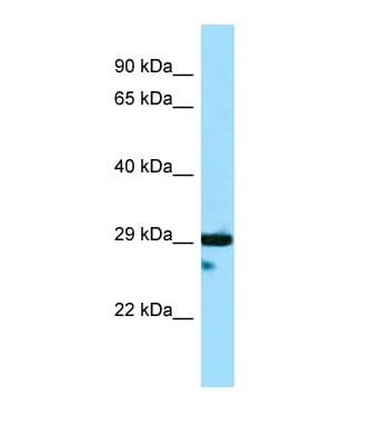 DTNBP1 / Dysbindin Antibody (aa191-240)