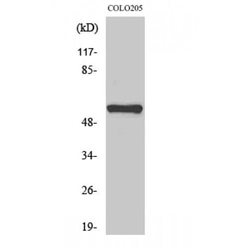 Polyclonal Rabbit anti-Human MITF Antibody (120-200 aa, IHC, IF, WB)