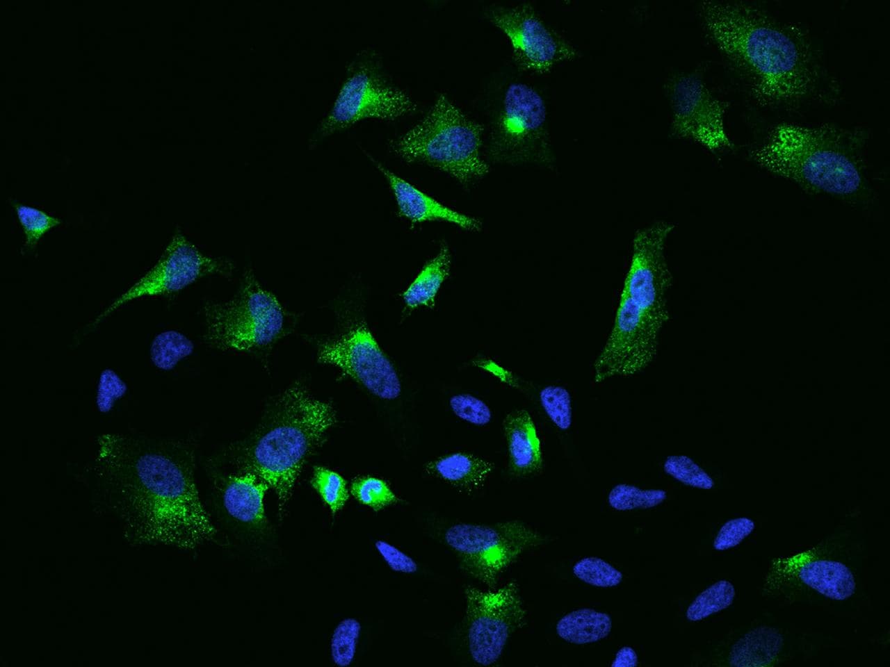 ADAM12 Antibody