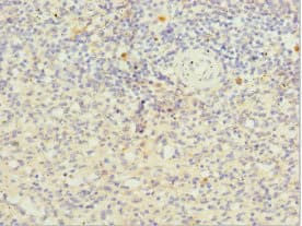 Polyclonal Rabbit anti-Human Scramblase / PLSCR1 Antibody (IHC, WB)