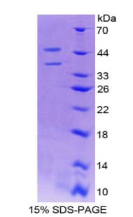Mouse PGF / PLGF Protein (Recombinant His-GST)