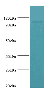 AP2B1 Antibody (aa738-937)