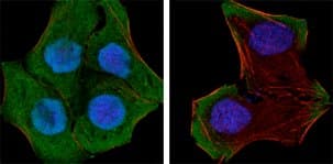 PTEN Antibody (clone 1B8)