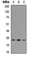 IHC-plus™ Polyclonal Rabbit anti-Human POLR3G Antibody (Internal, IHC, WB)