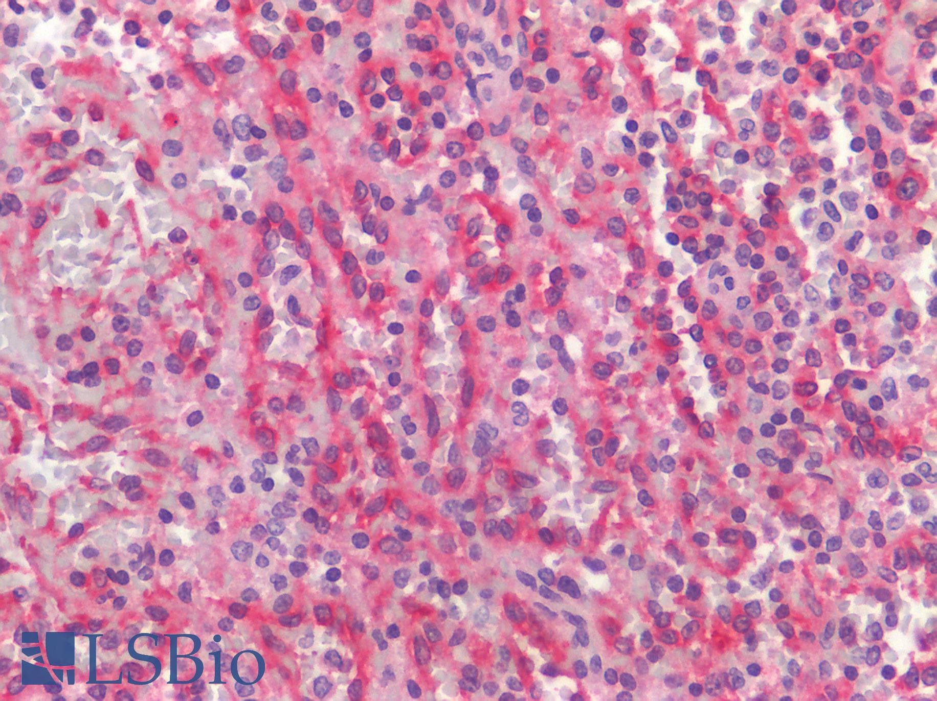 IHC-plus™ CCR6 Antibody (Extracellular Domain)