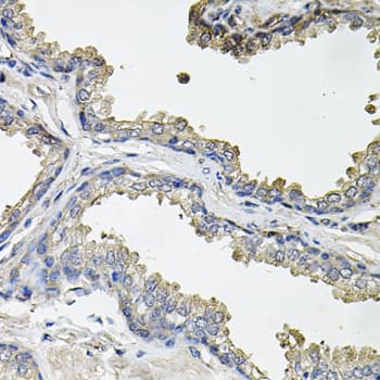 ACO1 / Aconitase Antibody