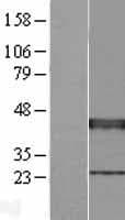 XRCC3 Protein (Over-Expression Lysate Myc-DDK (Flag))