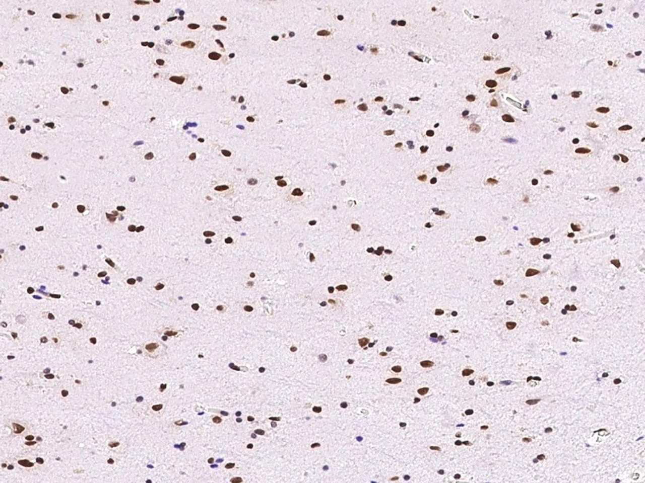 ONECUT1 / HNF6 Antibody (Preservative Free)