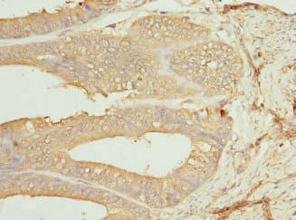 CSNK1G1 / CKI-Gamma 1 Antibody