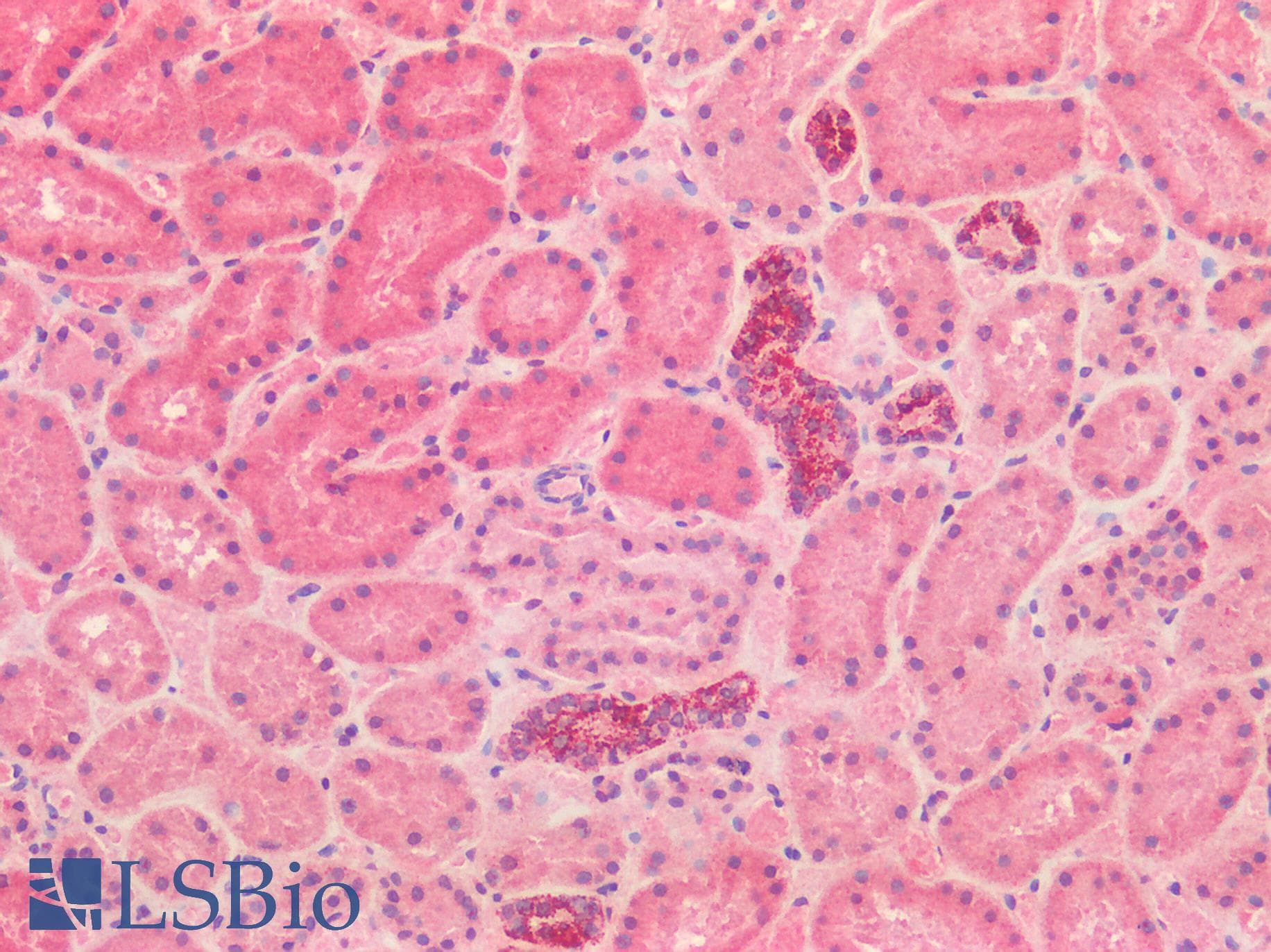 IHC-plus™ GLS / Glutaminase Antibody